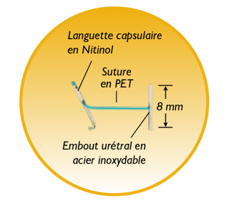 update_IMPLANT_SUTURE_FR copy